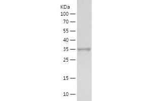 Western Blotting (WB) image for Lipoprotein Lipase (LPL) (AA 311-475) protein (His-IF2DI Tag) (ABIN7123780)