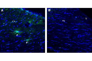 Immunohistochemical staining of perfusion-fixed frozen mouse brain sections using Anti-TMEM108 (extracellular) Antibody (ABIN7885615), (1:300), followed by goat anti-rabbit-.