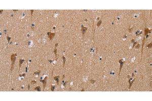 Immunohistochemistry of paraffin-embedded Human brain using POMT1 Polyclonal Antibody at dilution of 1:50 (POMT1 anticorps)