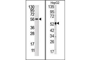 Image no. 1 for anti-Dual Specificity Phosphatase 4 (DUSP4) (C-Term) antibody (ABIN360778)