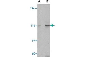 Western blot analysis of KIF5A in K-562 cell lysate with KIF5A polyclonal antibody  at (A) 0. (KIF5A anticorps  (C-Term))