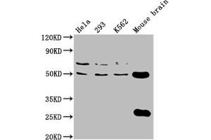 Western Blot Positive WB detected in: Hela whole cell lysate, 293 whole cell lysate, K562 whole cell lysate, Mouse brain tissue All lanes: TUBB4A antibody at 1:2000 Secondary Goat polyclonal to rabbit IgG at 1/50000 dilution Predicted band size: 50 kDa Observed band size: 50 kDa
