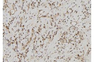 ABIN6278171 at 1/100 staining Human gastric tissue by IHC-P. (FDPS anticorps  (Internal Region))