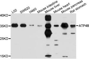 Western blot analysis of extracts of various cell lines, using ATP4B antibody (ABIN4902983) at 1:1000 dilution. (ATP4b anticorps)