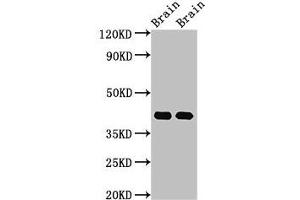 Western Blot Positive WB detected in: Rat brain tissue, Mouse brain tissue All lanes: Gnao1 antibody at 3 μg/mL Secondary Goat polyclonal to rabbit IgG at 1/50000 dilution Predicted band size: 41 kDa Observed band size: 41 kDa