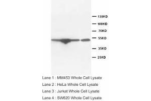 Image no. 2 for anti-Endothelin Receptor Type B (EDNRB) (Internal Region) antibody (ABIN1490394)