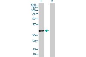 Western Blot analysis of VAPB expression in transfected 293T cell line by VAPB MaxPab polyclonal antibody. (VAPB anticorps  (AA 1-243))