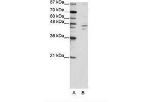 Image no. 1 for anti-Zinc Finger Protein 419 (ZNF419) (C-Term) antibody (ABIN202693) (ZNF419 anticorps  (C-Term))