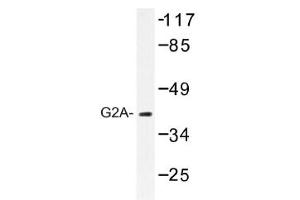 Image no. 1 for anti-G Protein-Coupled Receptor 132 (GPR132) antibody (ABIN317643) (G Protein-Coupled Receptor 132 anticorps)