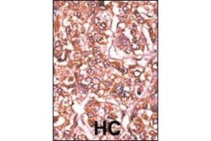 anti-Retinoblastoma 1 (RB1) (pSer612) antibody