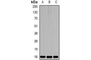 Western blot analysis of MsrB2 expression in mouse kidney (A), mouse brain (B), rat liver (C) whole cell lysates. (MSRB2 anticorps)