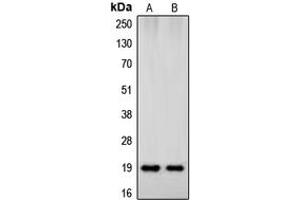 Western blot analysis of Beta-synuclein expression in HeLa (A), human brain (B) whole cell lysates. (beta Synuclein anticorps  (C-Term))