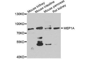 Western blot analysis of extracts of various cell lines, using MEP1A antibody. (MEP1A anticorps  (AA 440-700))