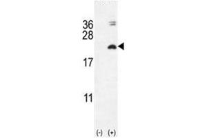 Western blot analysis of IL17F antibody and 293 cell lysate (2 ug/lane) either nontransfected (Lane 1) or transiently transfected with the IL17F gene (2).