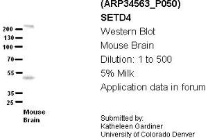 Image no. 2 for anti-SET Domain Containing 4 (SETD4) (C-Term) antibody (ABIN404949) (SETD4 anticorps  (C-Term))