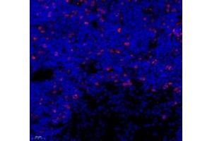Immunofluorescence of paraffin embedded rat thymus using Top2 (ABIN7075937) at dilution of 1:500 (400x lens) (Topoisomerase II alpha anticorps)