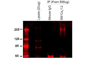 Immunoprecipitation analysis using Mouse Anti-CaV1.