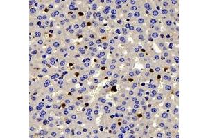 Immunohistochemistry of paraffin embedded mouse liver using IL-2 Receptor alpha (ABIN7074349) at dilution of 1: 200 (400x lens)