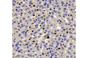 Immunohistochemistry of paraffin embedded mouse liver using IL-2 Receptor alpha (ABIN7074349) at dilution of 1: 200 (400x lens) (CD25 anticorps)