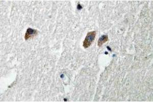 Immunohistochemistry (IHC) analyzes of CaMKIIbeta/gamma/delta antibody in paraffin-embedded human brain tissue. (CAMK2B anticorps)