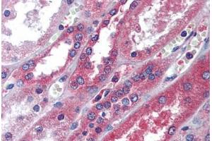 Human Kidney: Formalin-Fixed, Paraffin-Embedded (FFPE)