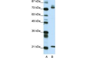 WB Suggested Anti-SATB1 Antibody Titration: 0. (SATB1 anticorps  (C-Term))