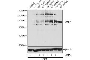 Western blot analysis of extracts of 293T cells, using GBP2 antibody  at 1:1000 dilution.