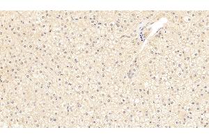 Detection of a1ACT in Human Liver Tissue using Polyclonal Antibody to Alpha-1-Antichymotrypsin (a1ACT) (SERPINA3 anticorps  (AA 235-394))