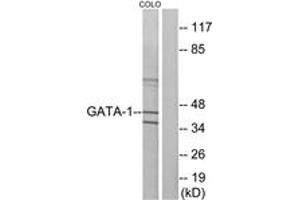 Western blot analysis of extracts from COLO cells, using GATA1 (Ab-142) Antibody. (GATA1 anticorps  (AA 109-158))