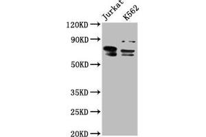 Western Blot Positive WB detected in: Jurkat whole cell lysate, K562 whole cell lysate All lanes: THEMIS antibody at 7. (THEMIS anticorps  (AA 547-641))