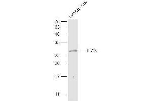 Mouse lymph node lysates probed with IL-13 Polyclonal Antibody, Unconjugated  at 1:500 dilution and 4˚C overnight incubation. (IL-13 anticorps  (AA 45-56))