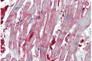 Human Heart: Formalin-Fixed, Paraffin-Embedded (FFPE)