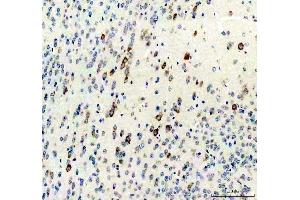 IHC analysis of Survivin/Calcitonin/CALCA using anti-Survivin/Calcitonin/CALCA antibody (ABIN4886497). (CGRP anticorps  (C-Term))