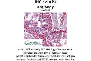 Image no. 2 for anti-Baculoviral IAP Repeat Containing 3 (BIRC3) (AA 314-508) antibody (ABIN1733088) (BIRC3 anticorps  (AA 314-508))