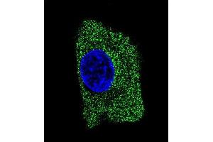 Confocal immunofluorescent analysis of LP2 Antibody 1851b with HepG2 cell followed by Alexa Fluor® 488-conjugated goat anti-mouse lgG (green). (LAMP2 anticorps)