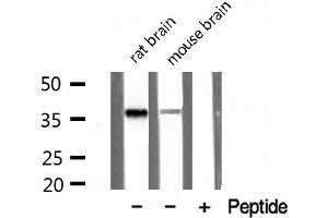 Western blot analysis of extracts of various tissue sample,using PDLIM1 Antibody . (PDLIM1 anticorps  (Internal Region))
