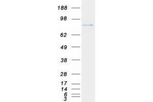 Validation with Western Blot