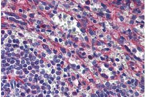 Human Spleen: Formalin-Fixed, Paraffin-Embedded (FFPE) (PLIN3 anticorps  (AA 1-435))