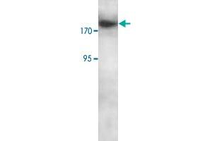 Western blot analysis of Jurkat cell lysate with RBBP6 polyclonal antibody  at 1 : 250 dilution. (RBBP6 anticorps  (C-Term))