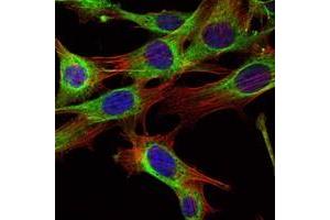 Immunofluorescence analysis of NIH/3T3 cells using ABL2 antibody (green). (ABL2 anticorps)