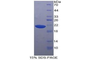 SDS-PAGE analysis of Human Hornerin Protein. (HRNR Protéine)