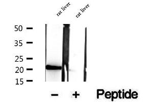 Western blot analysis of extracts of rat liver tissue, using CNPY2,MSAP antibody.
