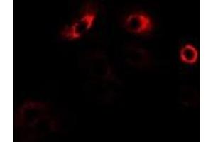 Immunofluorescent analysis of MPP2 staining in U2OS cells.