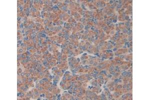 Used in DAB staining on fromalin fixed paraffin- embedded Kidney tissue