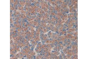 Used in DAB staining on fromalin fixed paraffin- embedded Kidney tissue (MTA1 anticorps  (AA 6-218))