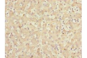 Immunohistochemistry of paraffin-embedded human liver tissue using ABIN7157720 at dilution of 1:100 (KLF15 anticorps  (AA 1-260))