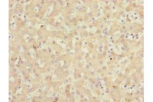 Immunohistochemistry of paraffin-embedded human liver tissue using ABIN7157720 at dilution of 1:100 (KLF15 anticorps  (AA 1-260))