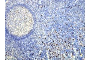 Immunohistochemistry (IHC) image for anti-lambda Light Chain (Lambda-IgLC) (AA 50-68), (N-Term) antibody (ABIN870374) (Lambda-IgLC anticorps  (N-Term))