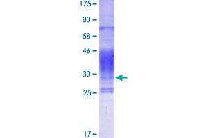 Image no. 1 for Tumor Necrosis Factor (Ligand) Superfamily, Member 8 (TNFSF8) (AA 63-234) protein (His-DYKDDDDK-Strep II Tag) (ABIN1323248)