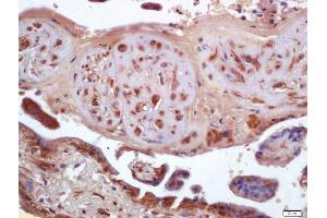 Formalin-fixed and paraffin embedded human placenta labeled with Anti-ANKRD1/CARP Polyclonal Antibody, Unconjugated (ABIN872716) at 1:200 followed by conjugation to the secondary antibody and DAB staining (ANKRD1 anticorps  (AA 185-319))